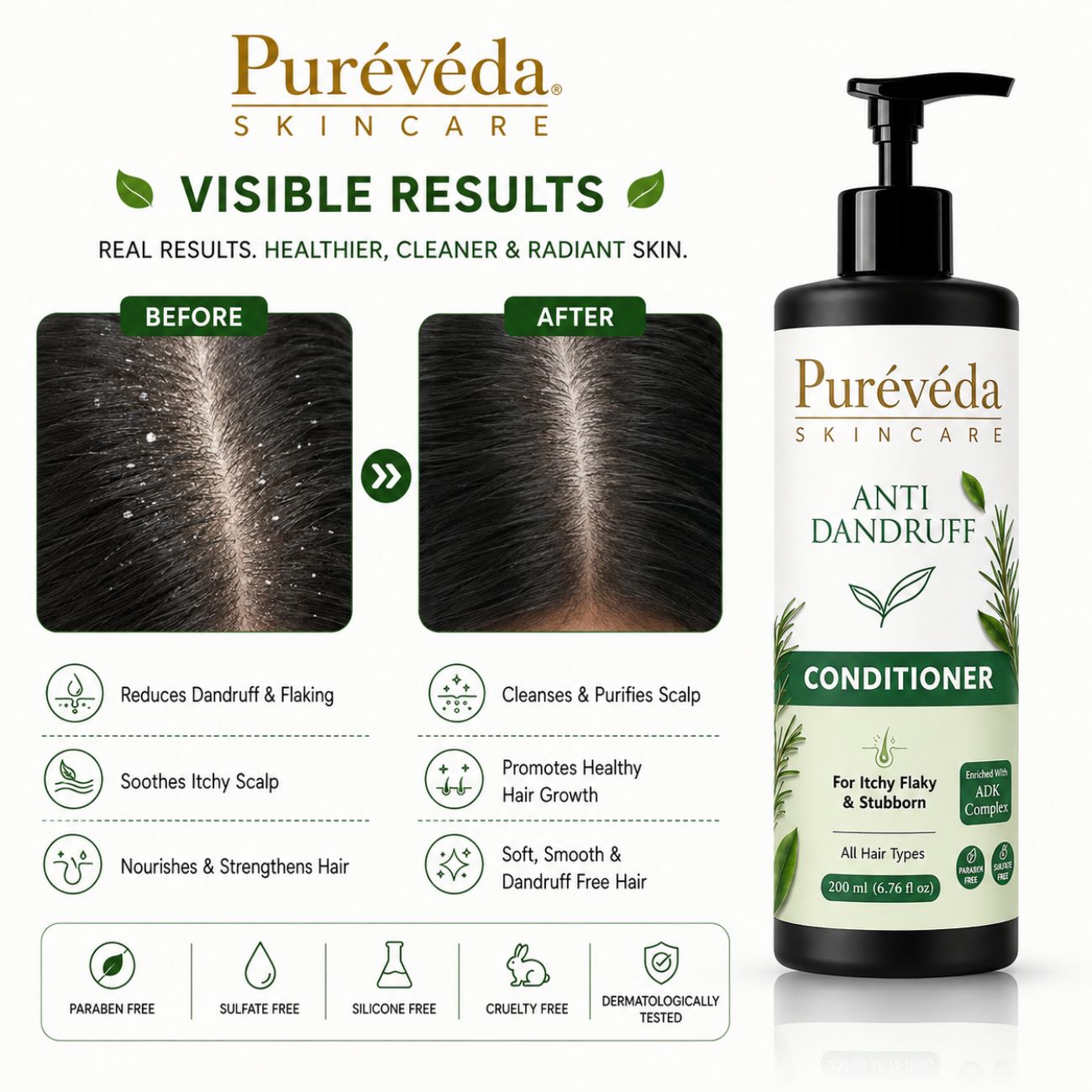 Anti Dandruff Conditioner for Itchy & Flaky Scalp