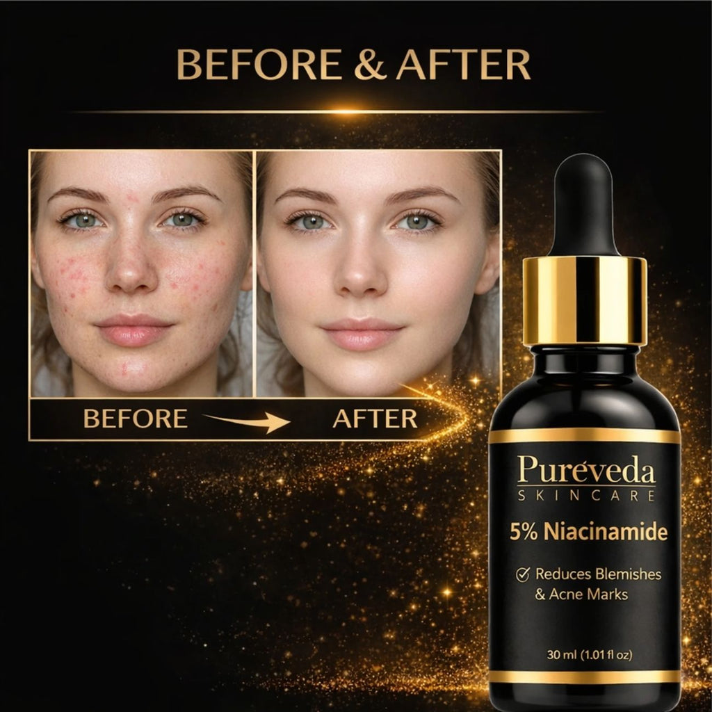 Pureveda 5% Niacinamide Face Serum – Blemishes & Acne Marks | 30 ml