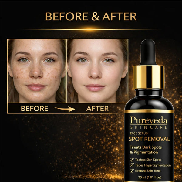 Pureveda Spot Removal Face Serum – Dark Spot & Pigmentation Care | 30 ml