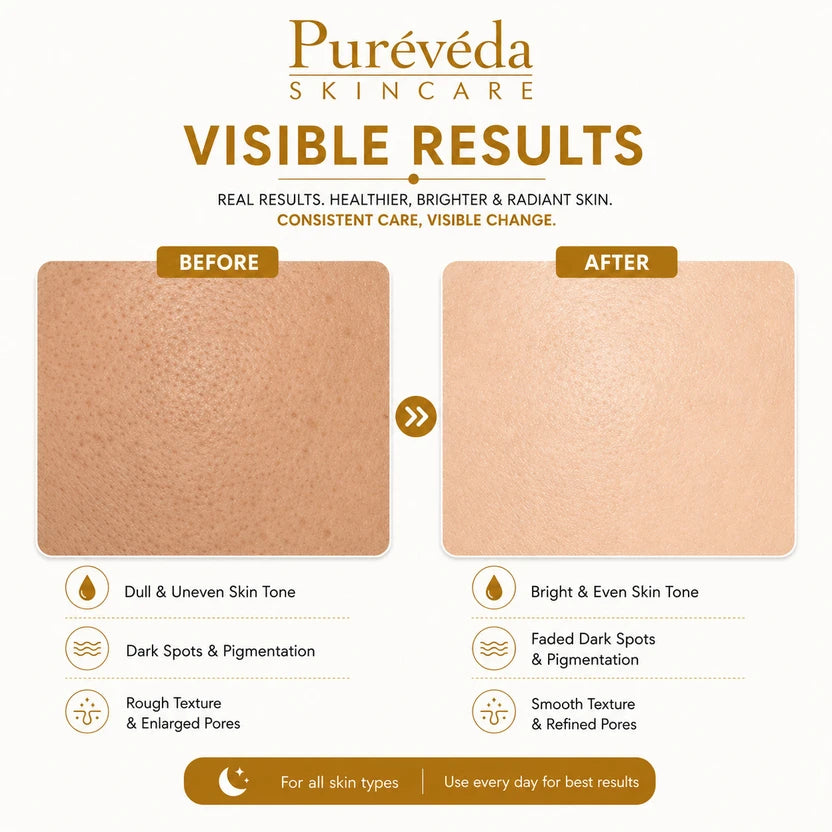 Pure Veda Skin Lightening Face Cream | Brightening Cream for Uneven Skin Tone | For Men & Women | 50g